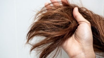 درمان موخوره بدون کوتاهی با روش های خانگی و طبیعی